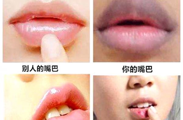 嘴唇周围发黑是什么原因 如何改善嘴巴周围发黑