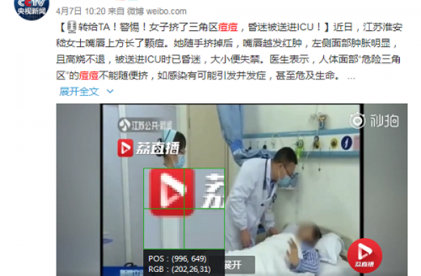 美丽策美容仪让你用最有效最安全的方法祛痘！