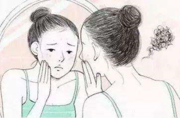 激素脸一直不好怎么办？讲解激素脸裸脸多久自愈