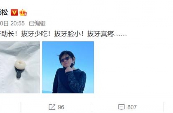 高晓松剪掉25年长头发！穿五千上衣钓鱼，肚子平坦无一点赘肉